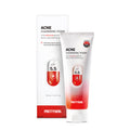 Acne Cleansing Foam